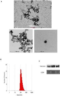 Extracellular Vesicles Derived From Colorectal Cancer Affects CD8 T Cells: An Analysis Based on Body Mass Index